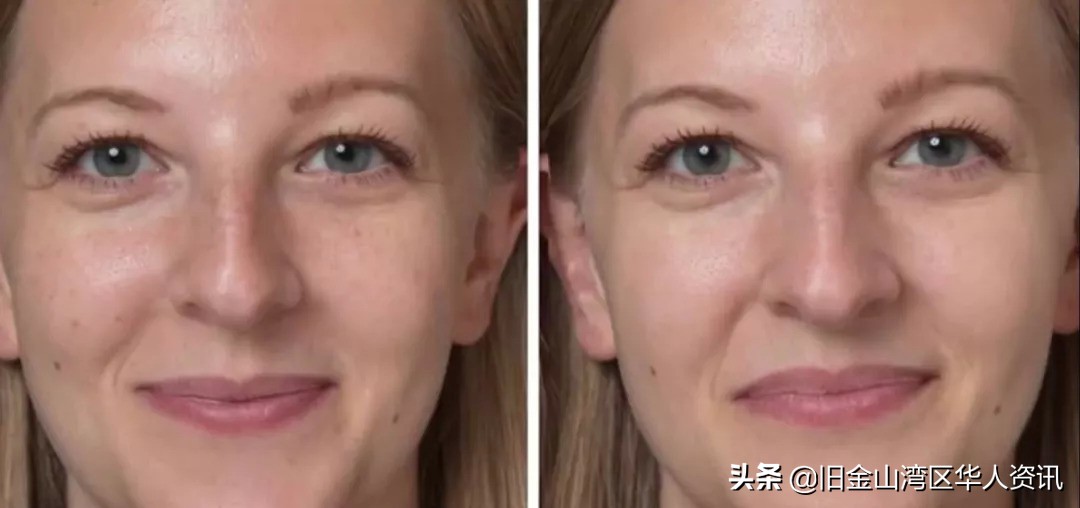 脸部处理ps,直接ps