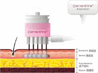 光子嫩肤脱毛仪的危害和禁忌,光子嫩肤注意事项文字