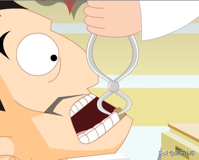 牙齿问题困扰和误区,不容忽视的牙齿问题