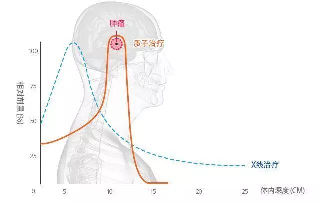 视网膜母细胞瘤6个月大的婴儿,视网膜母细胞瘤猫眼