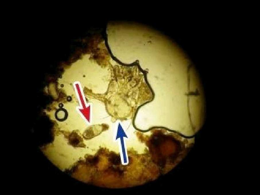 猫猫耳螨怎么治疗最好,在家怎么治疗喵咪耳螨