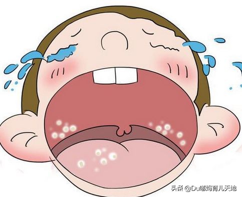 什么事鹅口疮？得了鹅口疮应该怎么办？