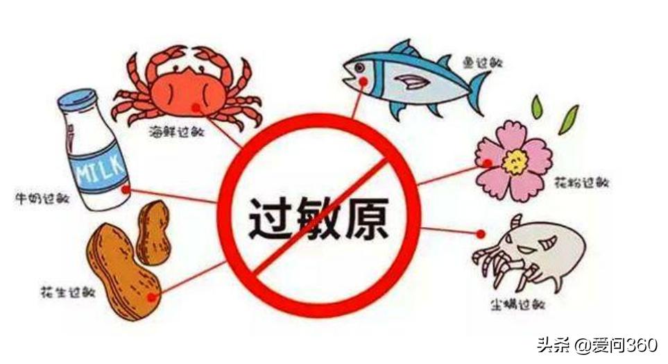 荨麻疹遇热重遇冷缓解怎么治,麻疹出现皮肤瘙痒用什么止痒