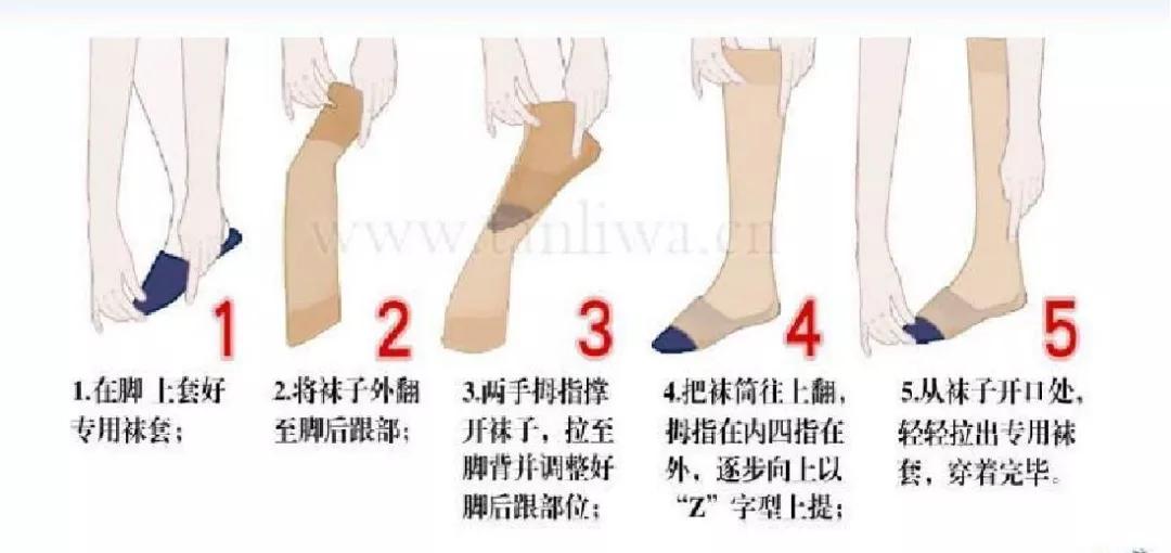 写在南丁格尔逝世纪念日——静脉曲张微创手术后，应该如何护理？