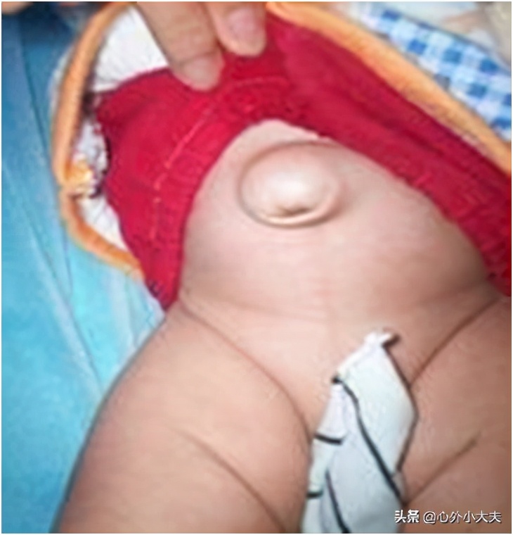 小儿外科常见疾病有哪些,儿童常见的外科疾病有哪些