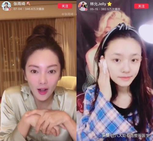 光子嫩肤会让皮肤变薄吗,长期光子嫩肤皮肤会变薄吗