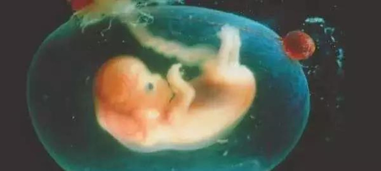 孩子出生的时候裹着羊膜囊怎么办,女婴连体衣护肚子