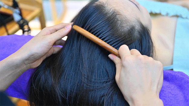 叹头部SPA！拒做人间“油”物，解锁防秃养发小妙招
