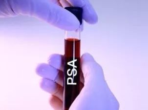 体检最难受的项目是哪几个,体检十大问题及解决方法