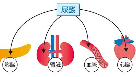 尿酸高不用药能自然恢复吗,尿酸高最快的恢复方法就是多喝水