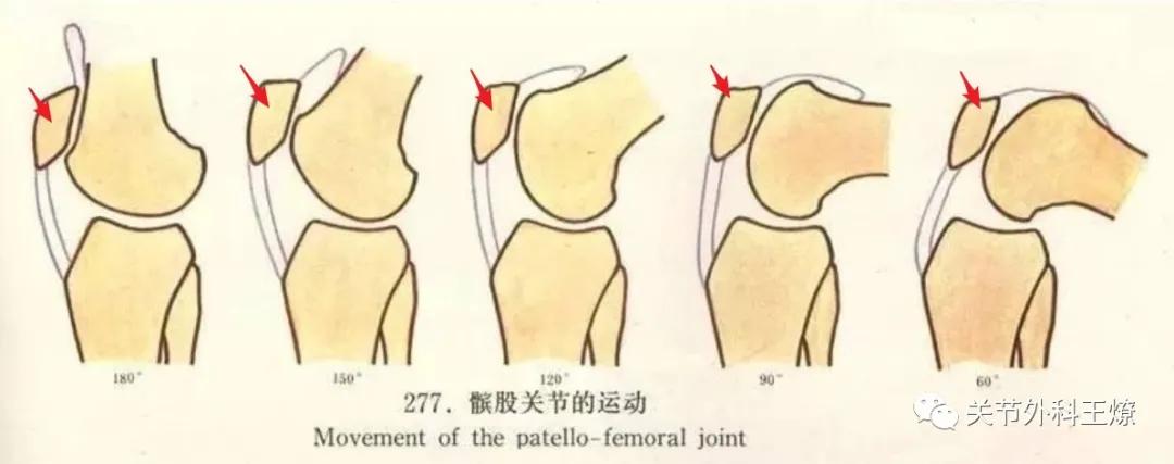 不可忽视的十种小病,不可忽视的膝关节疾病髌骨脱位