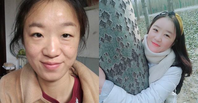 胶原蛋白该怎么补,脸上胶原蛋白流失严重怎么补最好