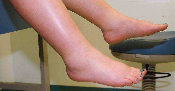 又孕吐又便秘怎么办,孕期孕吐严重便秘怎么办