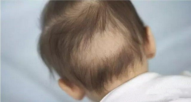 宝宝不停的摇头是啥意思,宝宝莫名其妙的摇头是什么情况