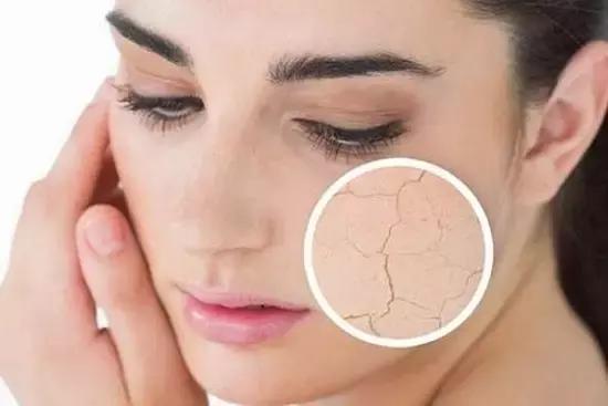 敷面膜脸上辣辣是怎么回事,用面膜过敏脸上火辣辣的怎么办