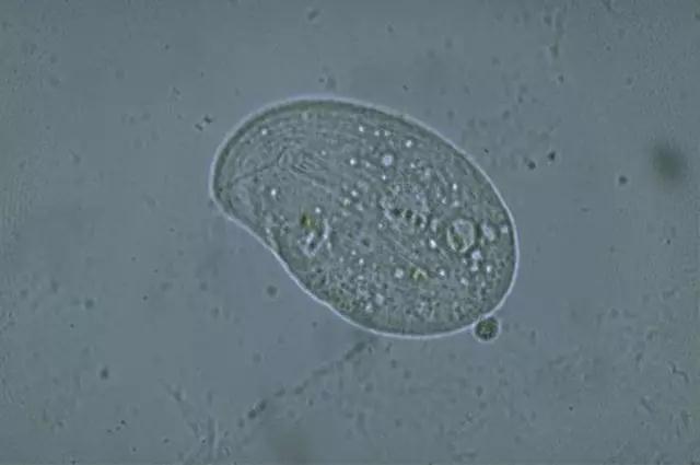 收藏!24种污水处理微生物菌相及指导意义,环保人必看(多图)