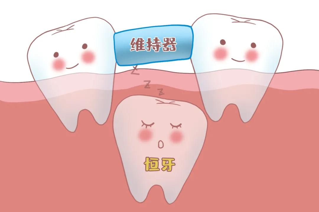 姚晨自曝儿子换牙问题，很多孩子中招！牙齿健康，家长们都要注意