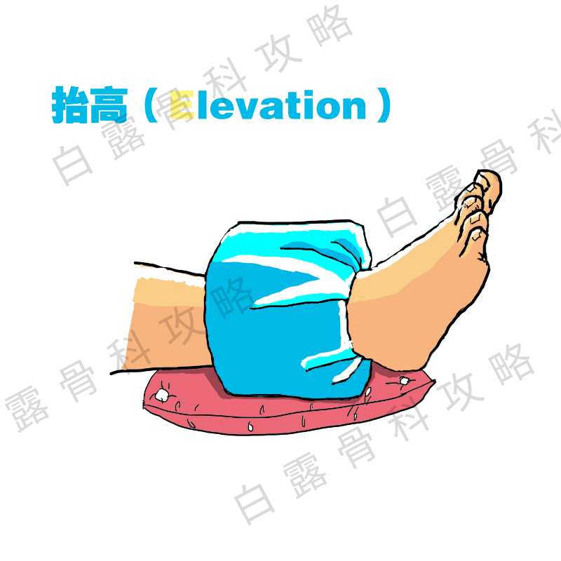 崴脚伤了脚踝怎么处理,崴到脚必须去正骨吗