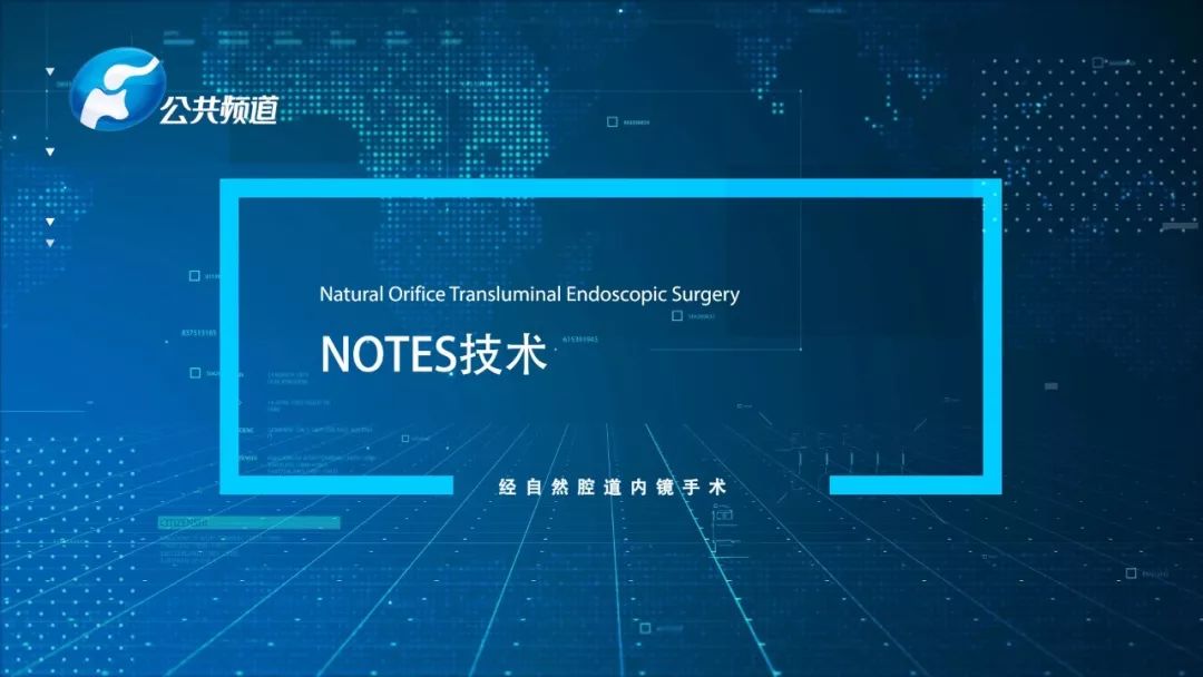 郑大一附院消化病院院长刘冰熔和他的NOTES技术：为国争光何惧苦累！