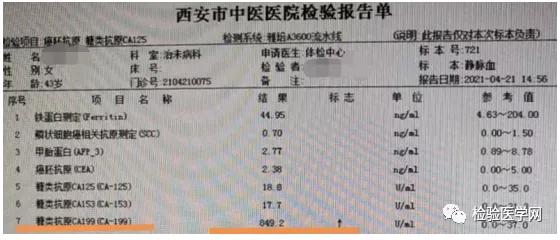 ca199一年比一年高原因,ca199前后相差20倍为什么