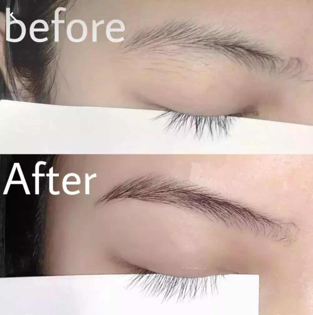 欧阳娜娜擦什么药膏好,欧阳娜娜安利祛疤膏