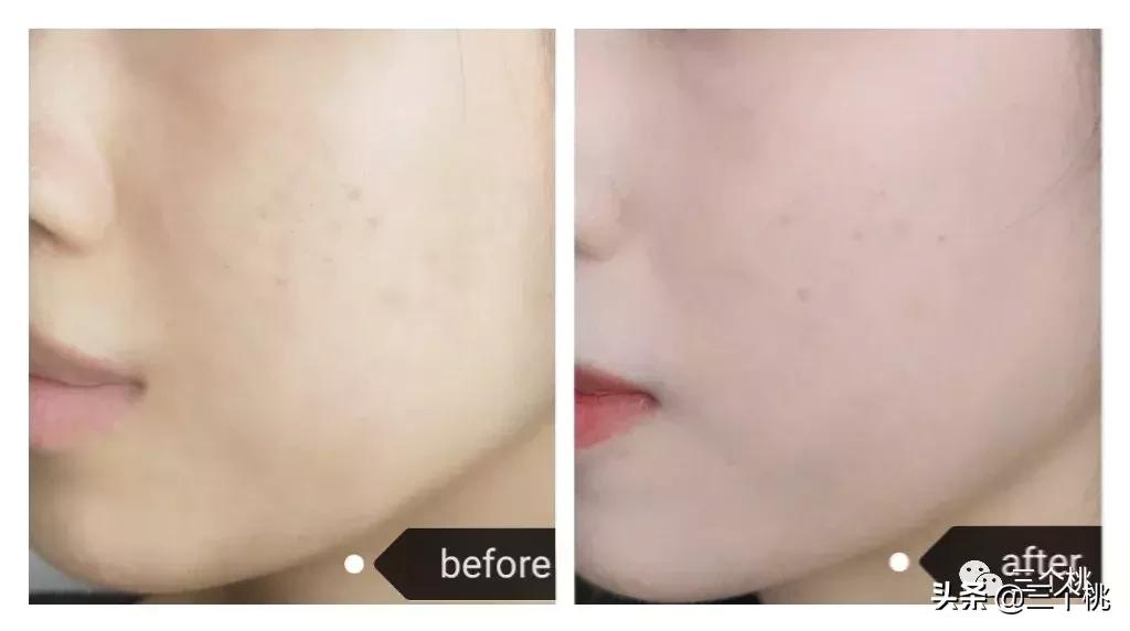 十大公认好用的粉底液评测,十大口碑最好的粉底液夏天