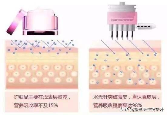 测评｜天天敷面膜和1个月打1次水光针，哪个效果好？