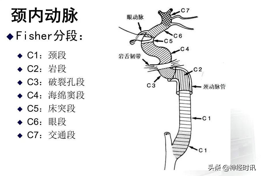 脑动脉解剖学讲解,脑膜中动脉解剖讲解