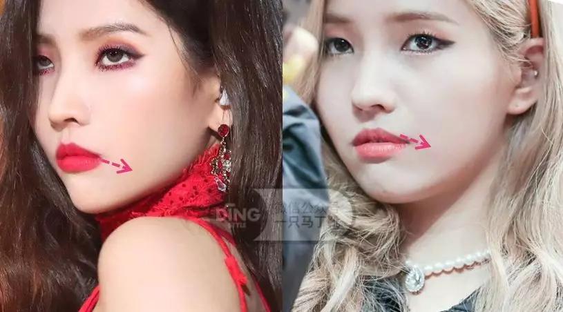 戴牙套凸嘴怎么化妆,凸嘴整牙削骨吗