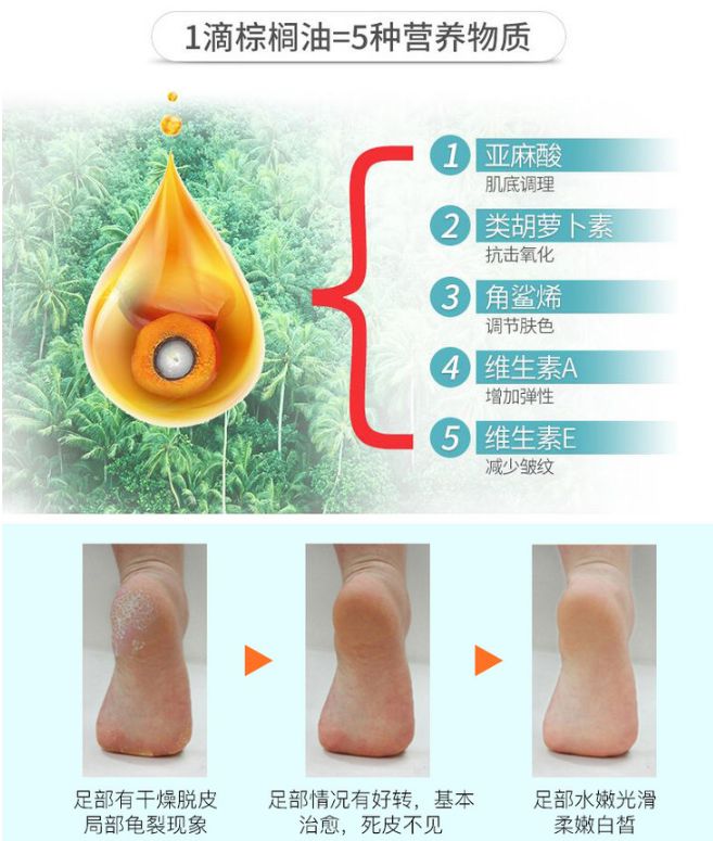 脚气脚臭脚痒的克星用什么,用什么泡脚可以治愈脚气