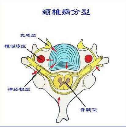 中医治疗颈椎病哪家好,中医马自明治疗颈椎病