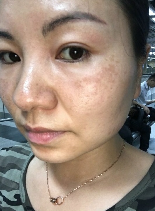 维e乳膏的其他妙用,维e可以和其他药膏一起用吗