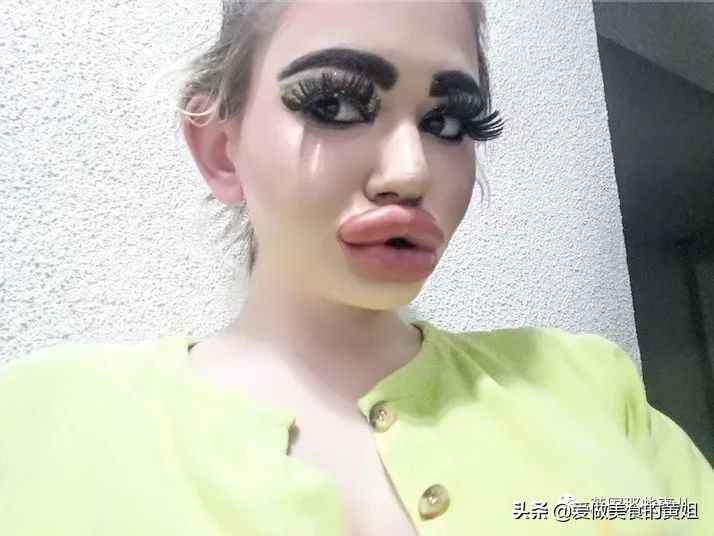 20次整容成功的女人,22岁女人做20次丰唇手术