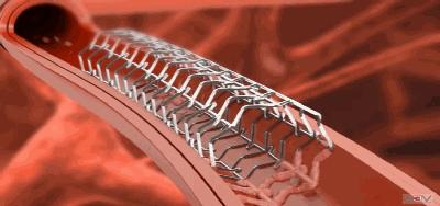 “我的心又不疼！”香港老板忙着上市，却被深圳医生“拖”住！