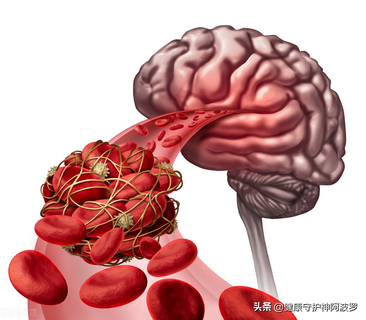高血压不吃药泡泡脚就能降血压吗,55岁高血压跑步降血压能不吃药吗