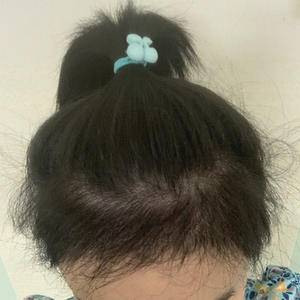 发际线太高怎么办初中生,发际线太高怎么办学生党