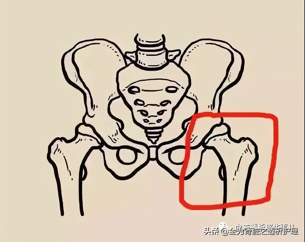 老年人跌倒预防措施及宣教,老年人预防跌倒的注意事项