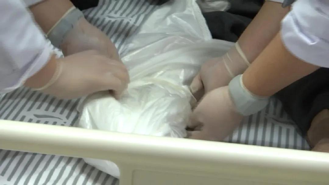 久拖成重疾！男子右脚冻伤后严重坏死