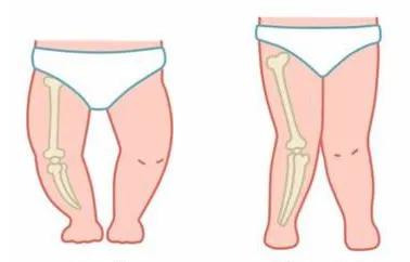鎬庢牱鍒ゆ柇瀛╁瓙鏄痮鍨嬭吙,濡備綍鍒ゆ柇瀛╁瓙鏄惁o鍨嬭吙