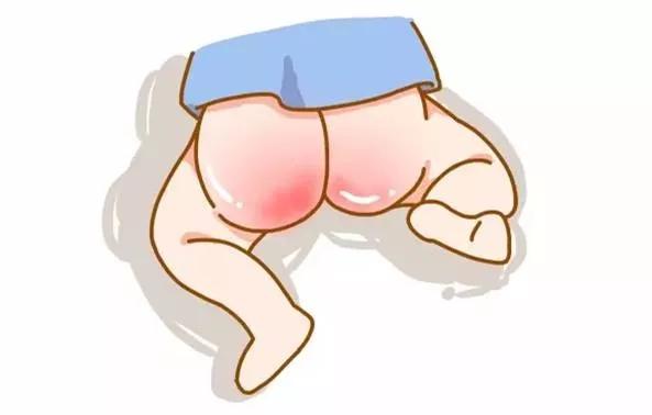 怪不得宝宝总是红屁屁，原来是这里出了问题！