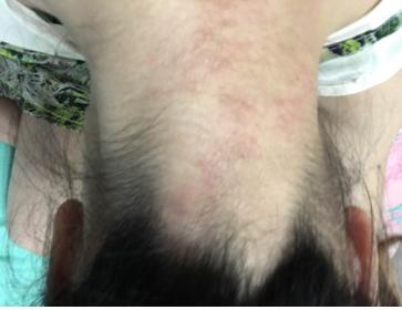 居家必备最全的家庭药品常备清单,最实用常备药品