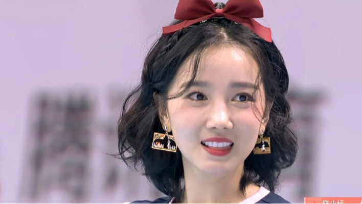 哪个明星做了颧骨内推,颧骨内推明星前后对比