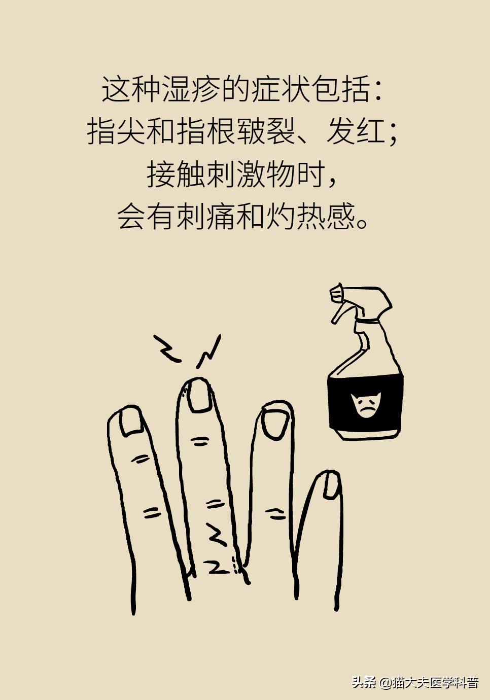 成年人手上总是长湿疹怎么办？