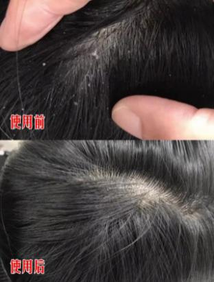 澳洲茶树精油洗发水去头屑,头发一摸全是油