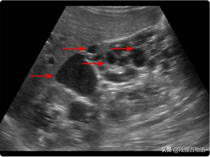 猫咪遗传性肾衰竭会死吗,猫咪肾脏肿大疾病有哪些