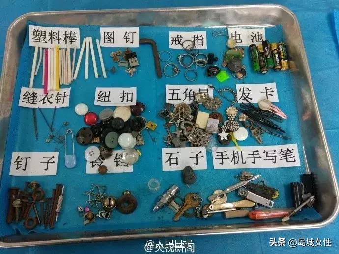 8岁男孩误吞5厘米钢钉,惊险9岁男孩误吞3厘米图钉