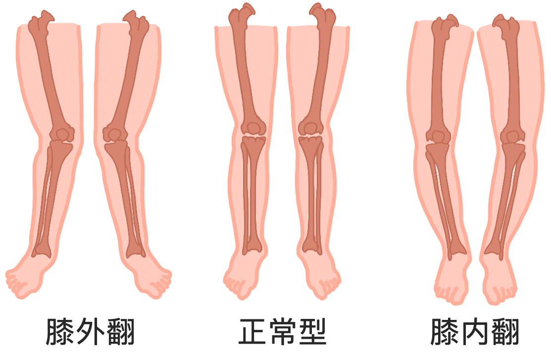 请教我的膝关节病如何治疗,到底要不要治疗膝关节