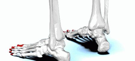 习惯性崴脚怎么锻炼脚踝力量,脚踝习惯性崴脚怎么恢复