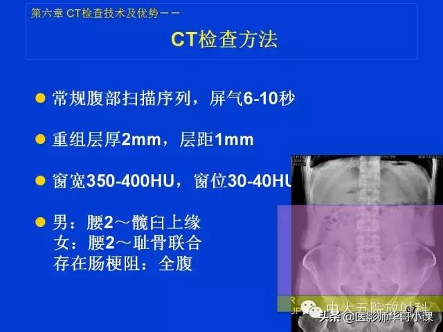 阑尾炎课件,阑尾炎的超声课件