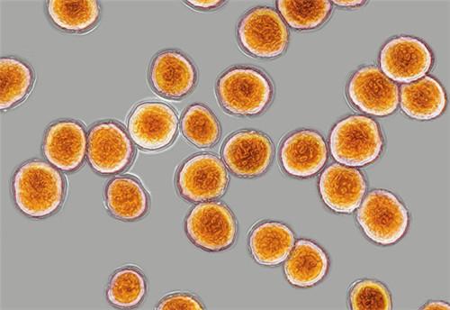 拔牙会引起肺部感染症状,女生拔牙感染